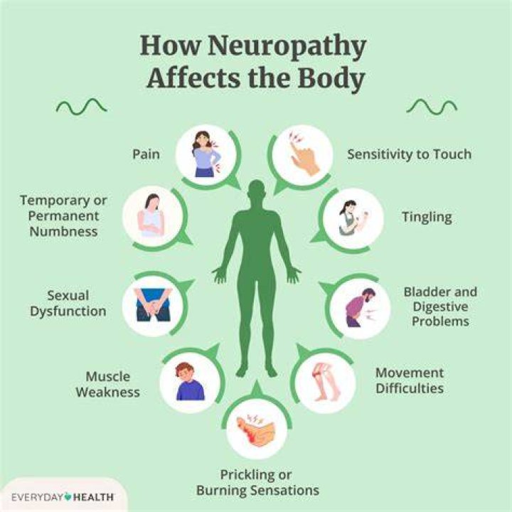 Does neuritis go away?