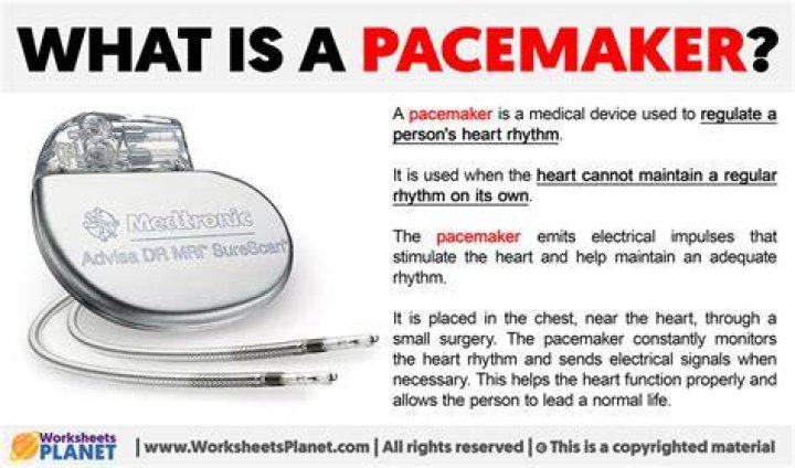 What is a pacemaker called?